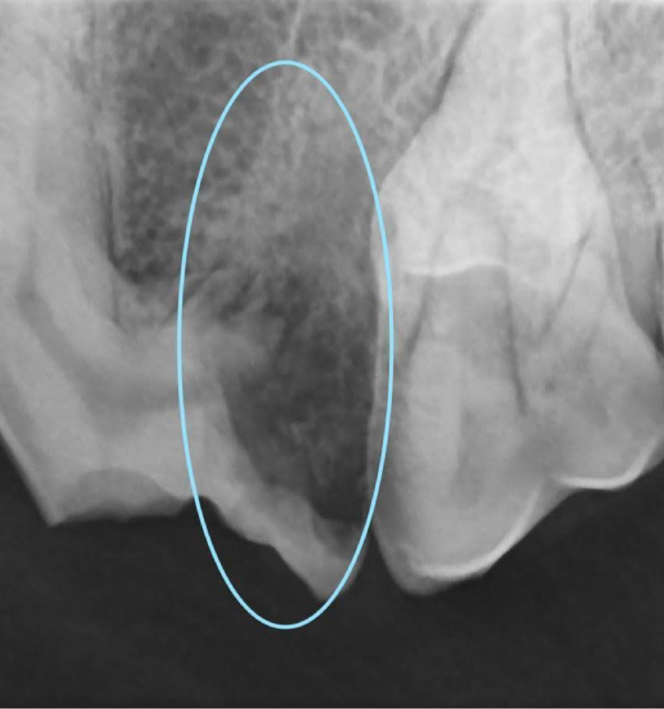Dental Image